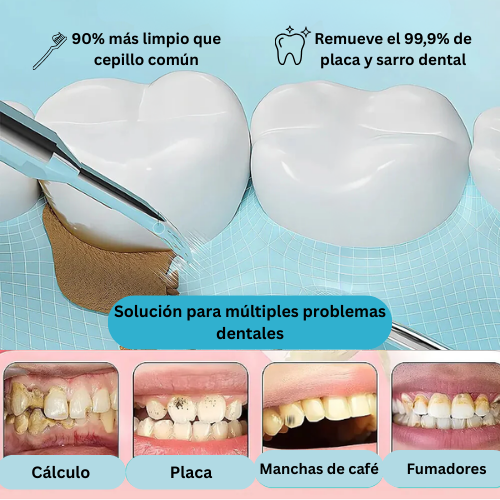 SmileX® | Removedor de Sarro 3 en 1