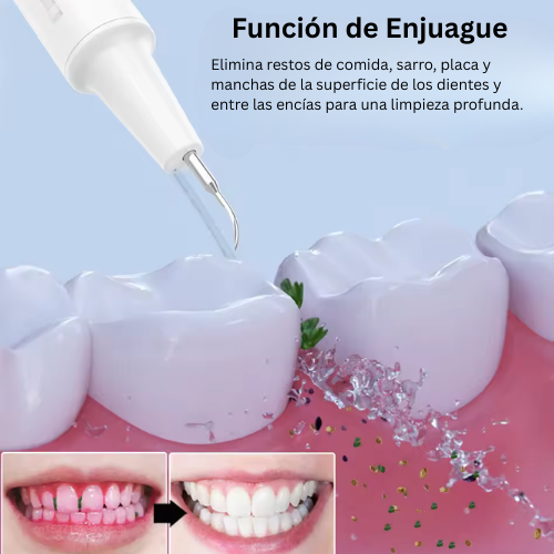 SmileX® | Removedor de Sarro 3 en 1