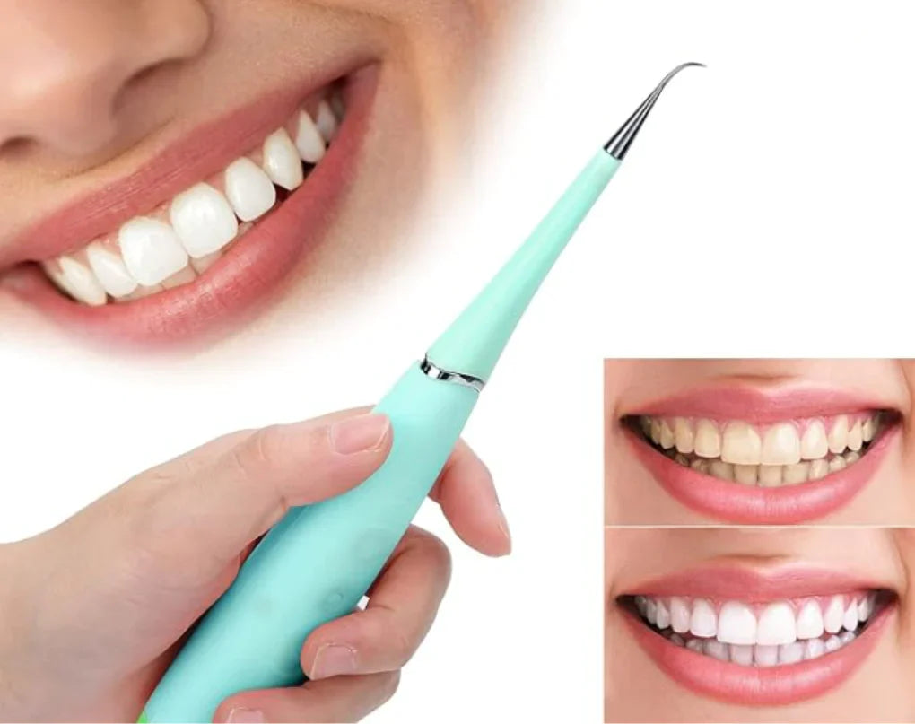 SmileX® | Removedor de Sarro 3 en 1